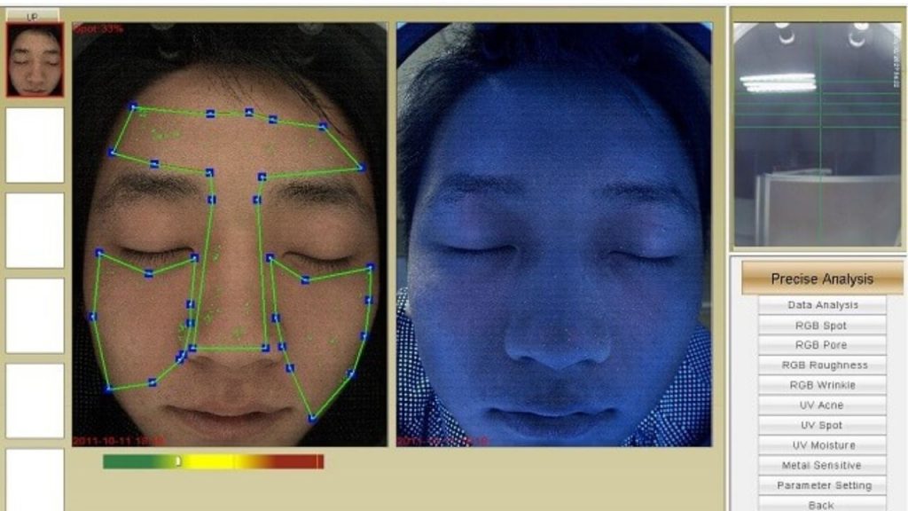 máy soi da cắt lớp cho độ chính xác đến 99%