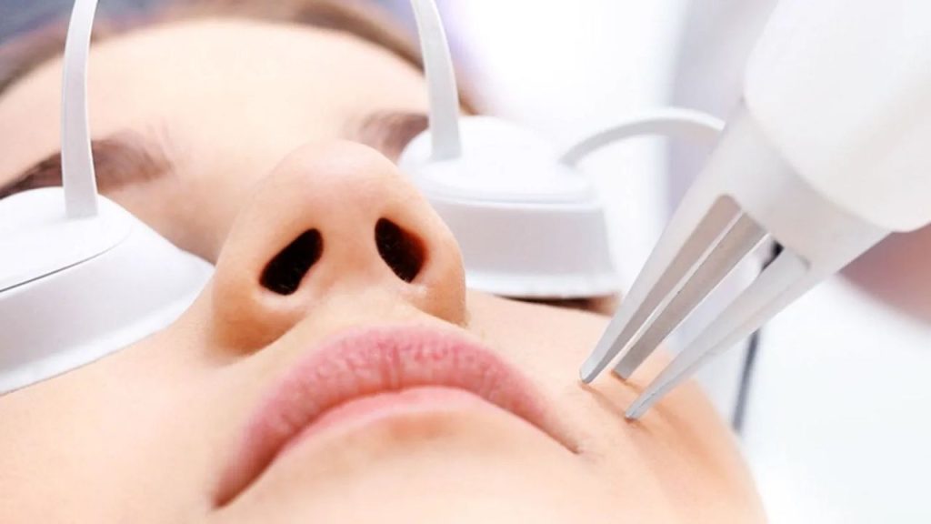 Laser thẩm mỹ tác động như thế nào với làn da