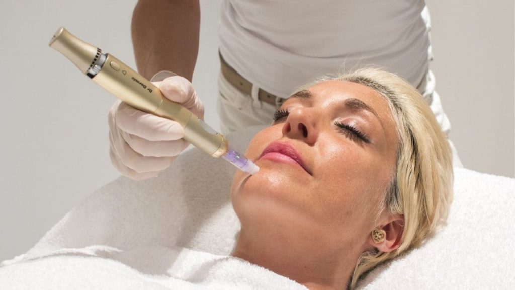 Thiết bị vi kim tế báo gốc tốt nhất hiện nay