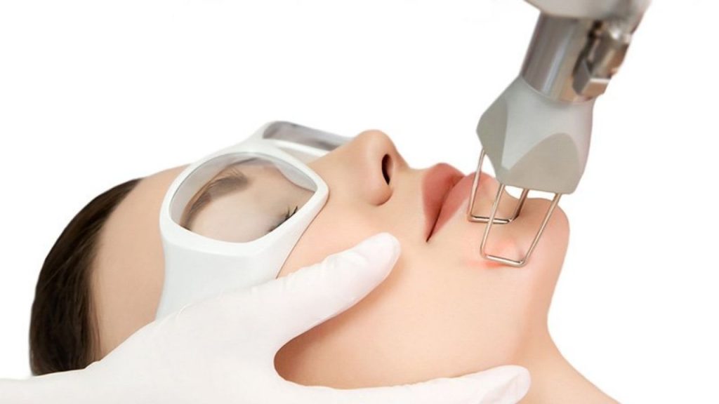Phương pháp làm đẹp hiệu quả với laser xoá nhăn