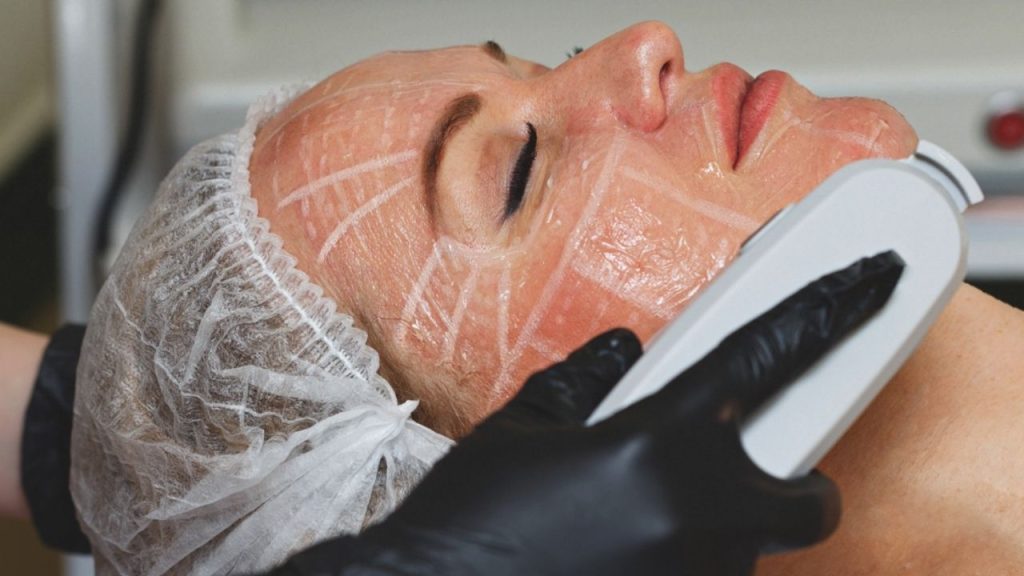 Công nghệ trẻ hóa da an toàn hiệu quả cao