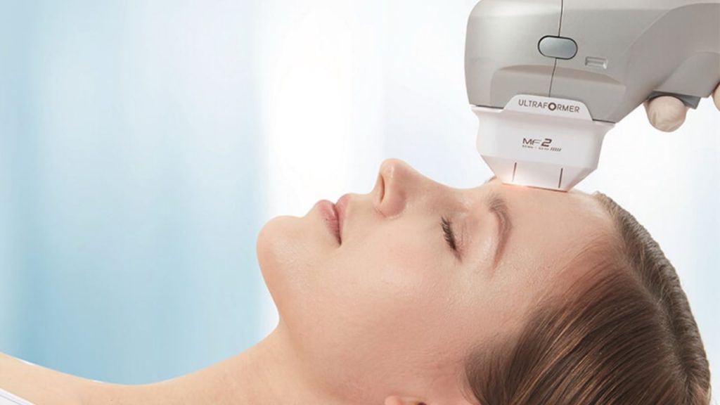 Liệu trình hifu nâng da cải thiện nhan săc