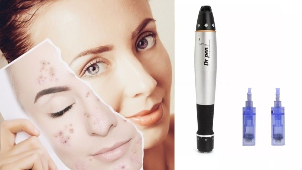 Máy phi kim có tác dụng gì tới da