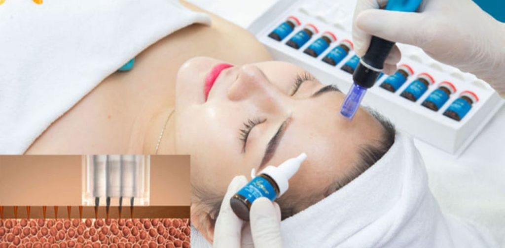 Máy phi kim tích điện chất lượng cao