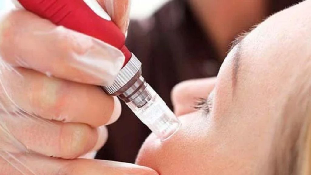 Mua máu phi kim ở đâu tốt nhất