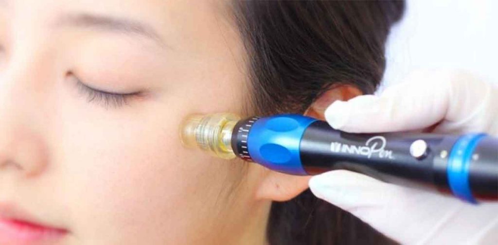 Máy phi kim tảo biển chính hãng