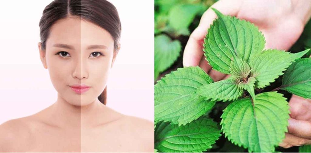 Cách trị nám bằng lá tía tô gian dân hiệu quả