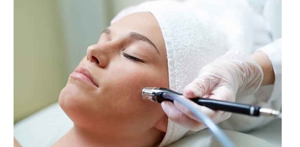 Bắn laser trị nám hiệu quả chăm sóc da tốt để nhanh bong vảy