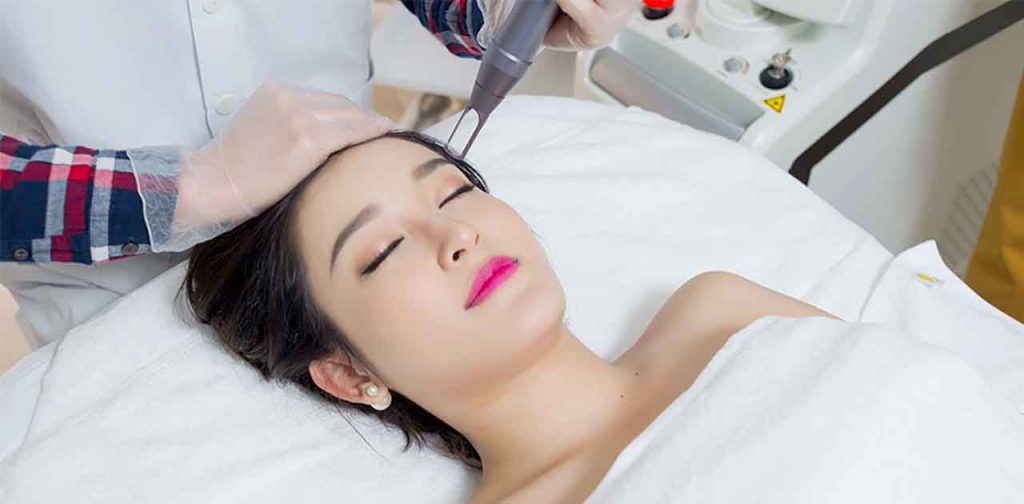 Bắn laser trị nám đảm bảo hết