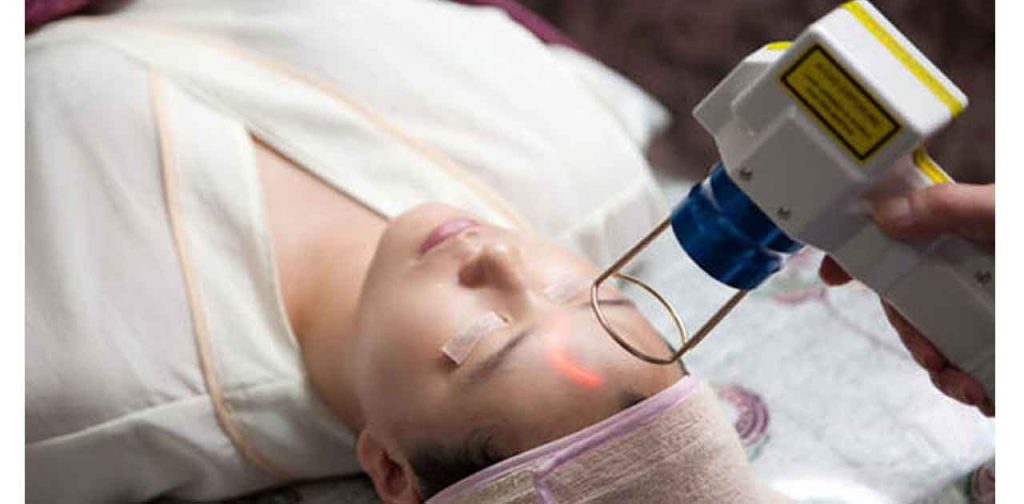 Bắn laser trị nám thực sự mang lại hiệu quả dành cho chị em