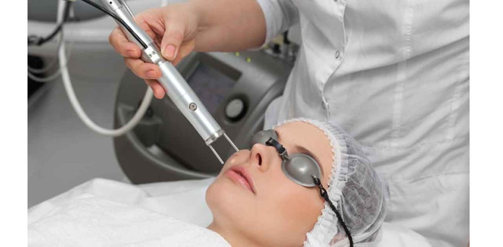 Các phương pháp loại bỏ nám bằng laser hiệu quả