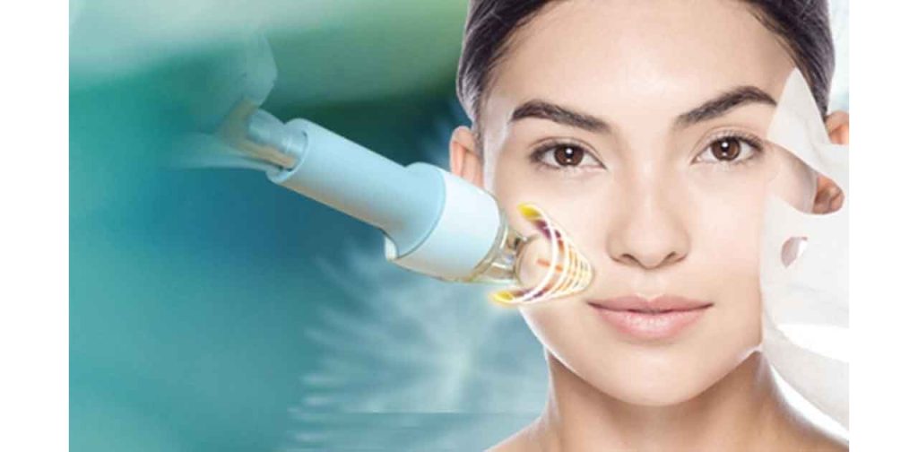 Thông tin chi phí bắn laser trị nám