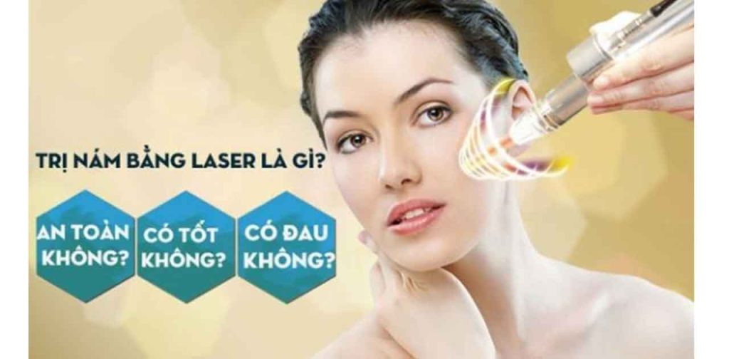 Nên trị nám với laser giúp đánh bay nám