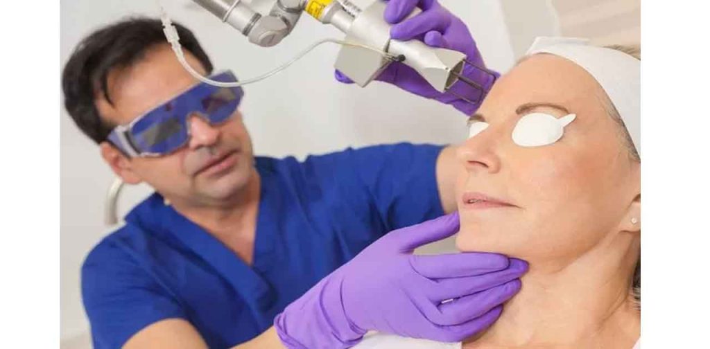 Laser giúp đánh bay nám, tàn nhang một cách nhanh chóng