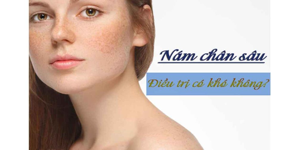 Laser trị nám chân sâu hiệu quả ra sao