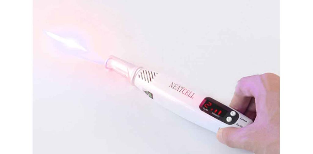 Top 3 thiết bị trị nám mini tốt nhất hiện nay