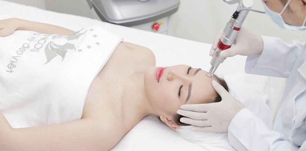 Trị nám với laser phương pháp làm đẹp hiệu quả