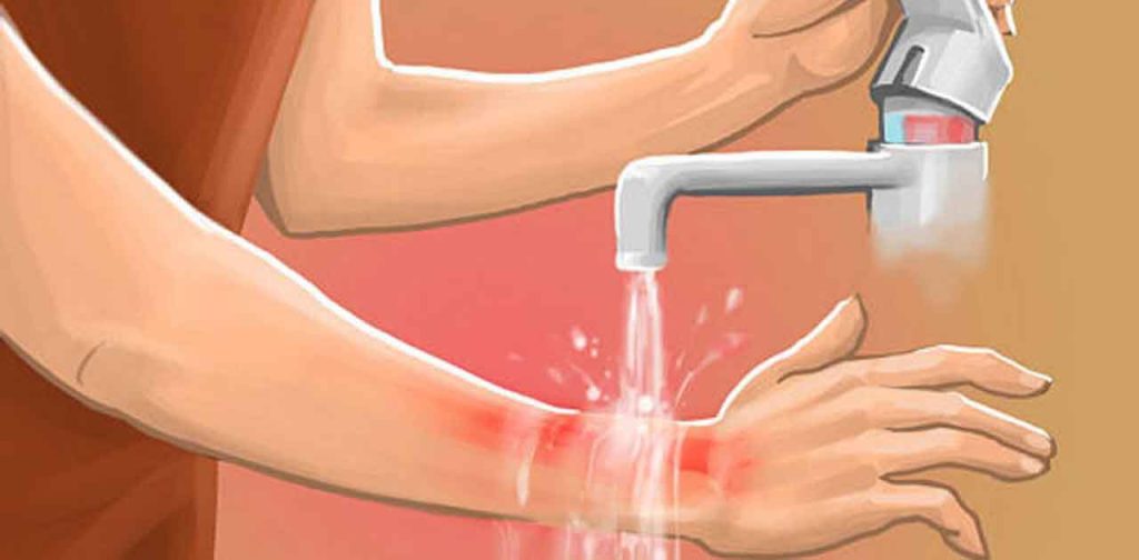 các phương pháp trị sẹo bỏng bô xe máy