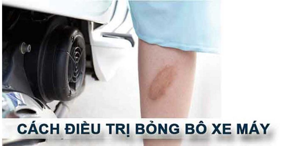 Các dòng máy trị sẹo bỏng bô nhập khẩu