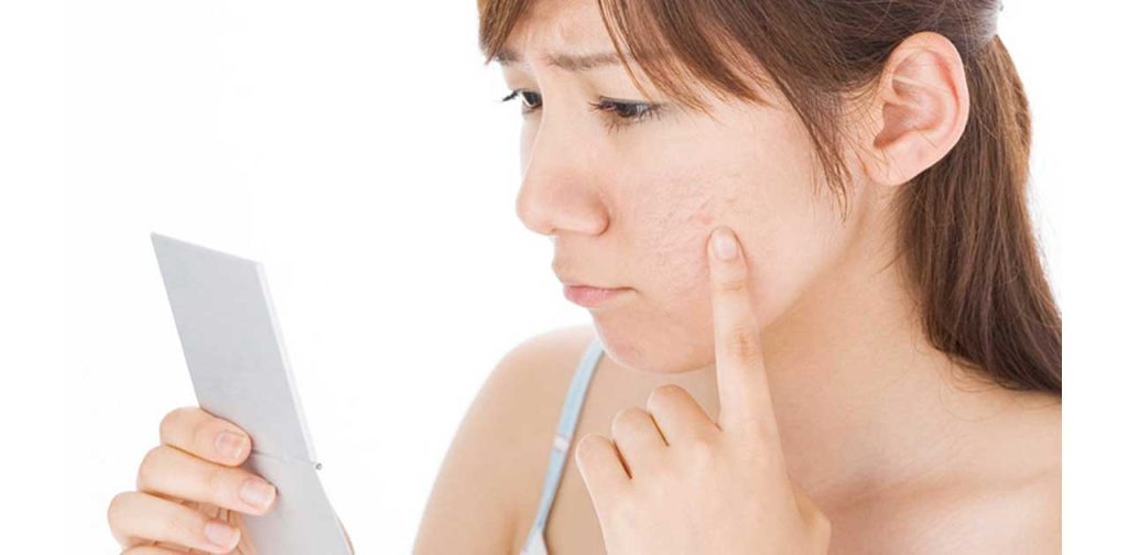 Các thiết bị trị sẹo của Nga