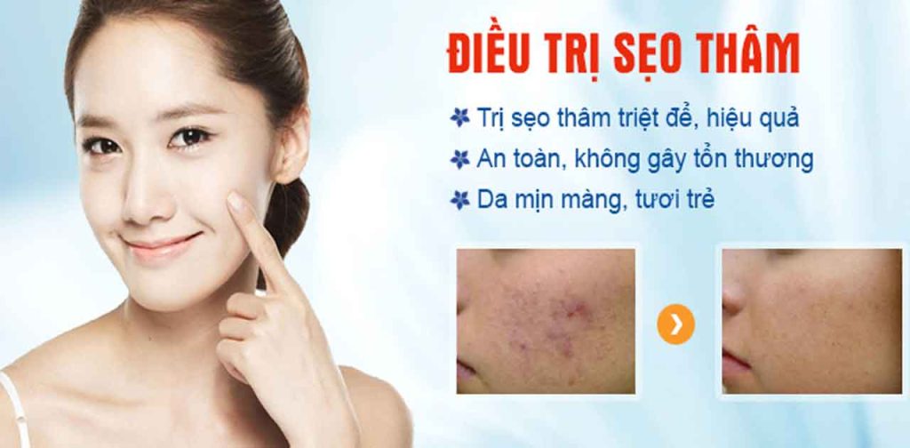 Thiết bị trị sẹo doctor scar