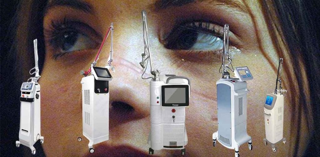 5 Dòng máy trị sẹo hiệu quả nhất