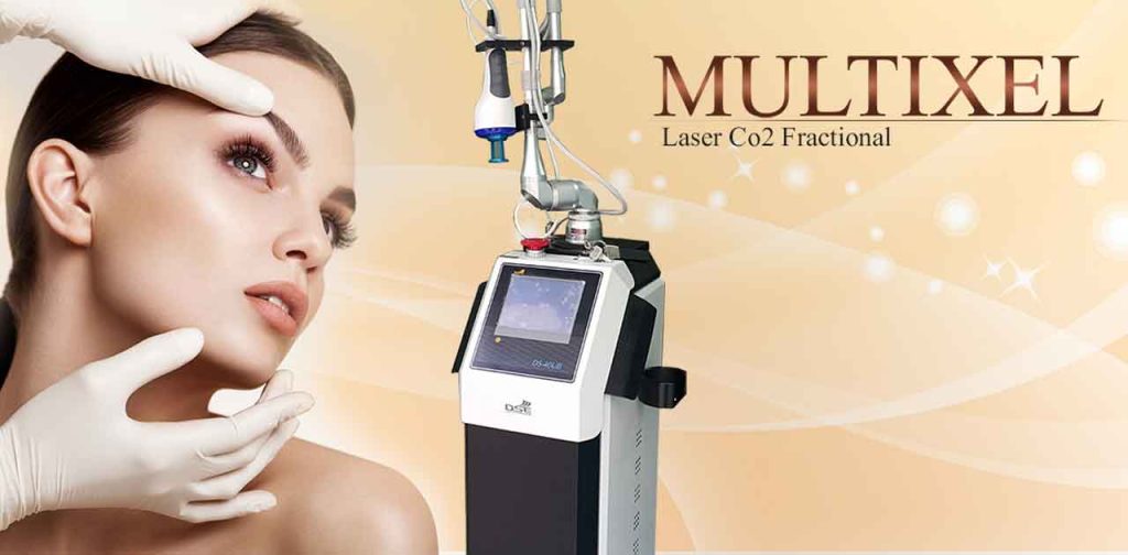 3 dòng máy trị sẹo an toàn hiệu quả nhất hiện nay