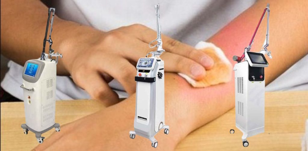 Các thiết bị trị sẹo phỏng bằng laser