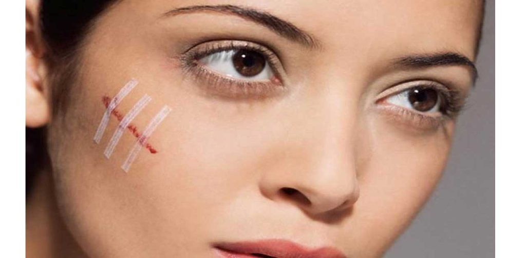 3 Dòng máy trị seo tại nhà tốt nhất