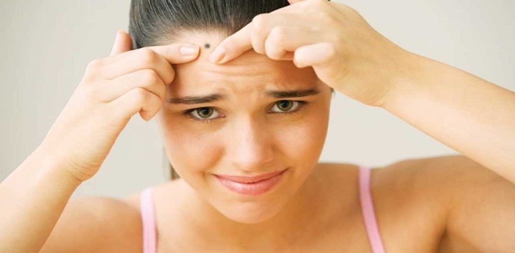 Các thiết bị trọ sẹo sau khi xoá nốt ruồi