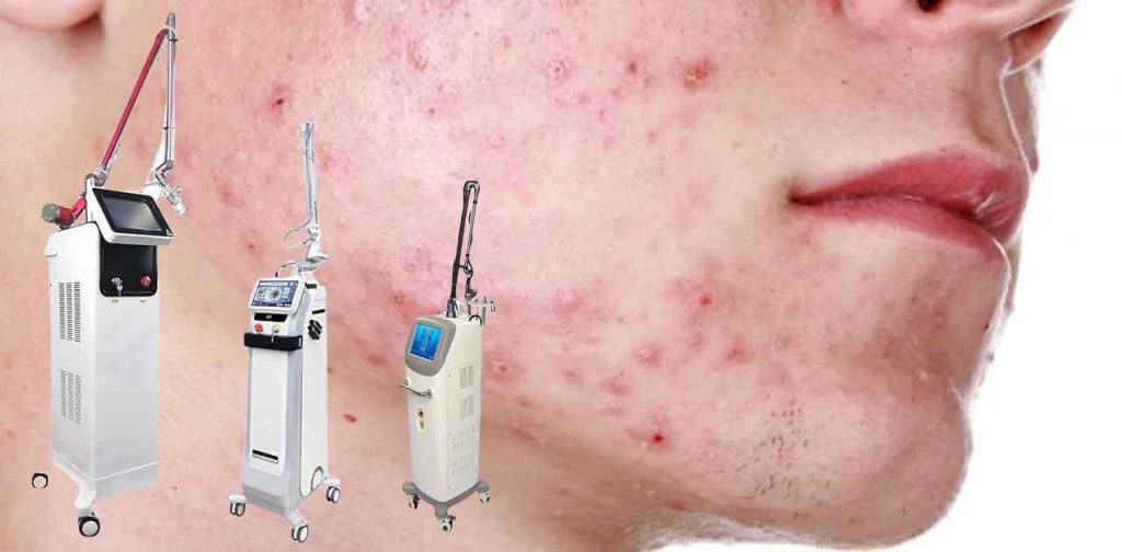 Thiết bị trị sẹo sau trị mụn