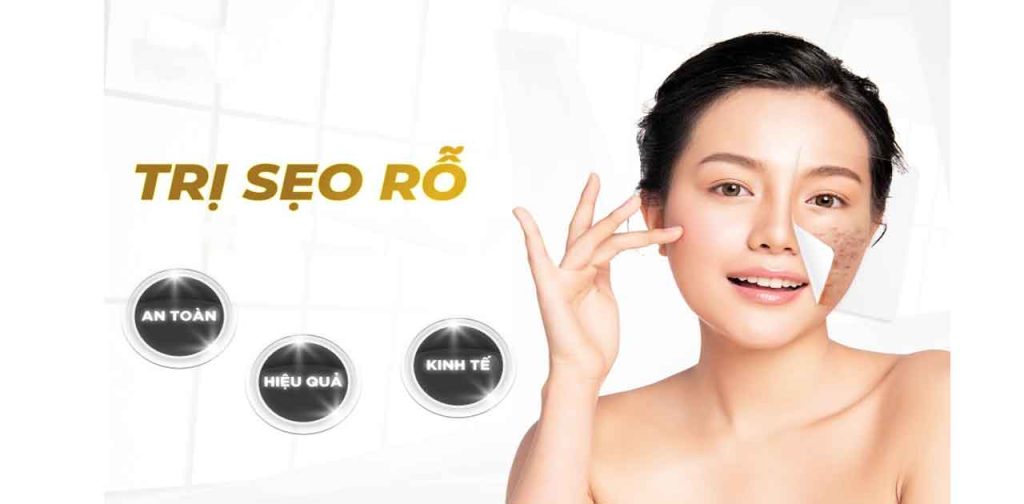4 máy laser trị sẹo rỗ cao cấp
