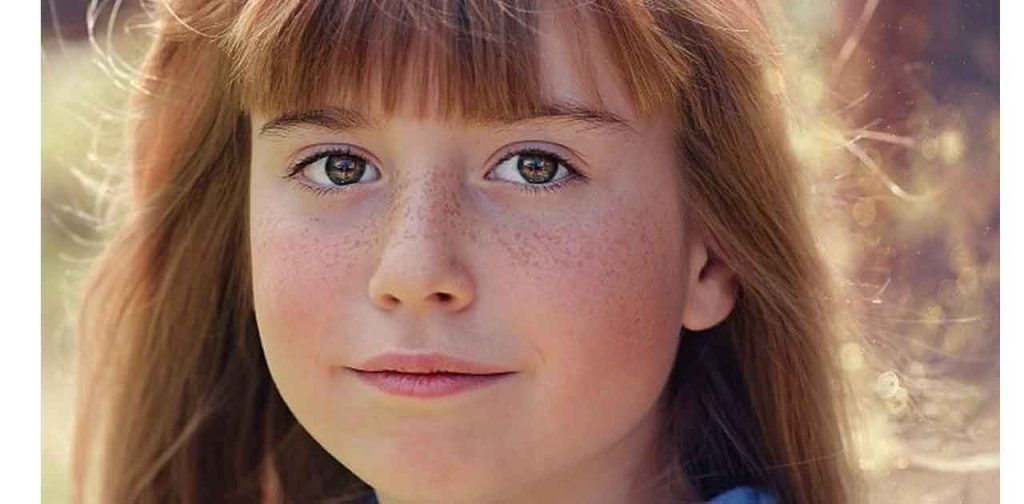 Cách trị tan nhang bẩm sinh hiệu quả