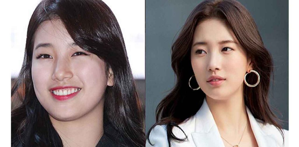 Công nghệ làm thon gọn khuôn mặt hiệu quả nhất