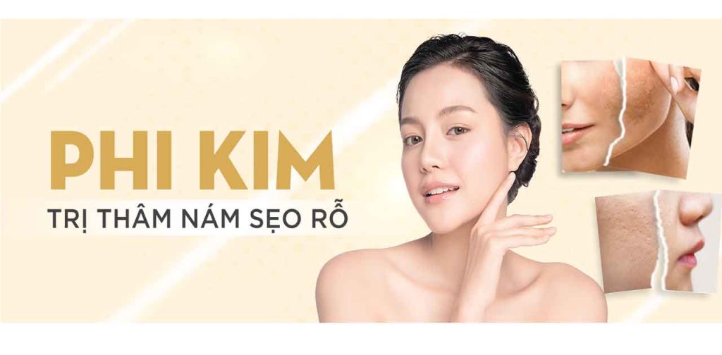 Máy phi kim trị sẹo rỗ cao cấp