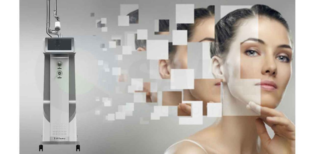 Top 3 dòng máy trị sẹo thịnh hành nhất đà nẵng