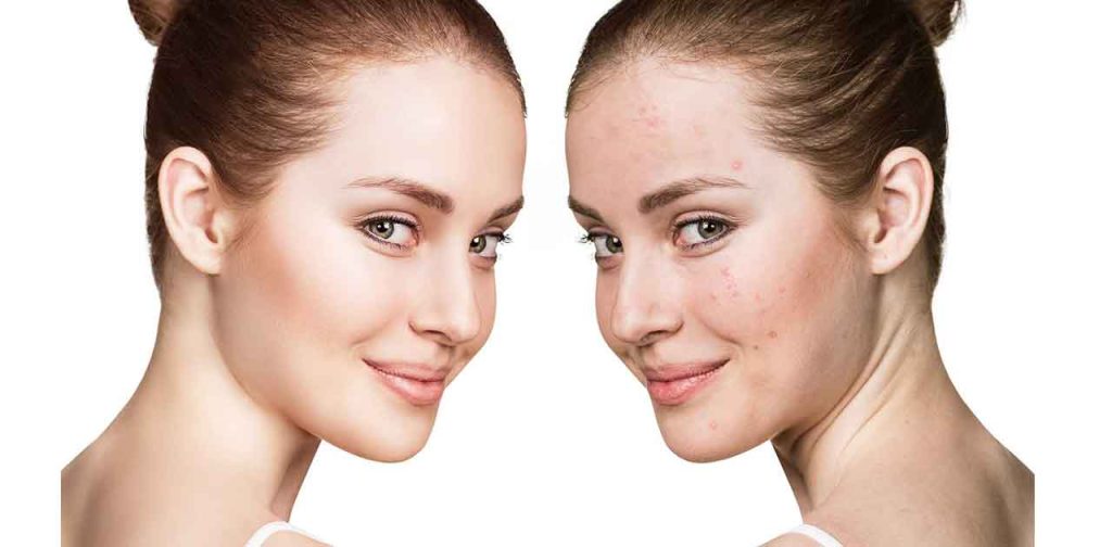 Thiết bị làm đẹp chữa lành sẹo tại TPHCM