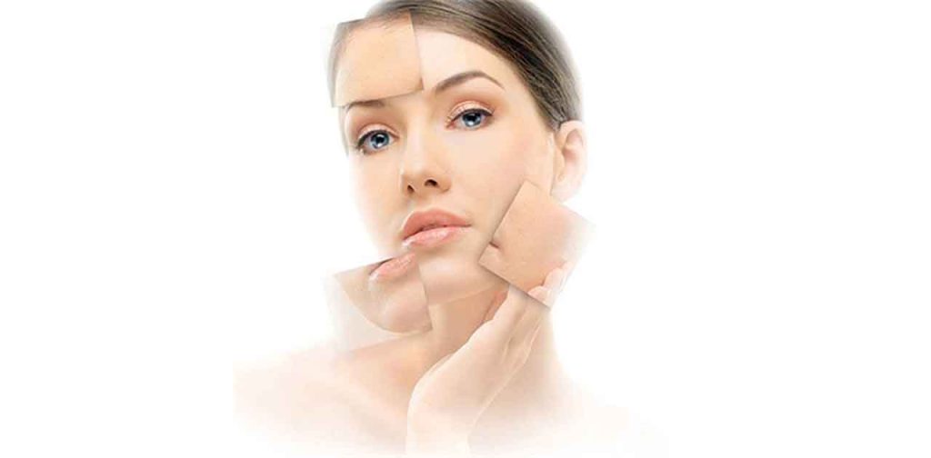 Các phương pháp bắn tia laser trị tàn nhang