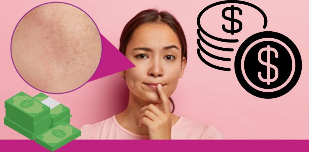 Giá của phương pháp bắn tia laser trị tàn nhang