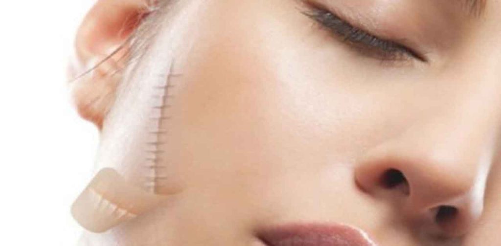 Các dòng thiết bị làm đẹp trị sẹo trên mặt hiệu quả nhất