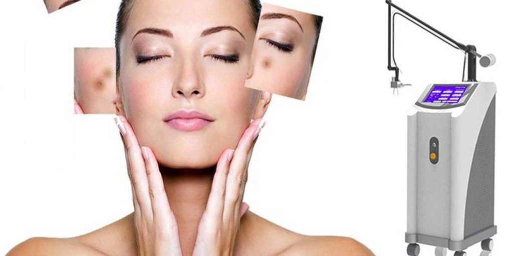 Các dòng máy trị sẹo xấu lâu năm cao cấp