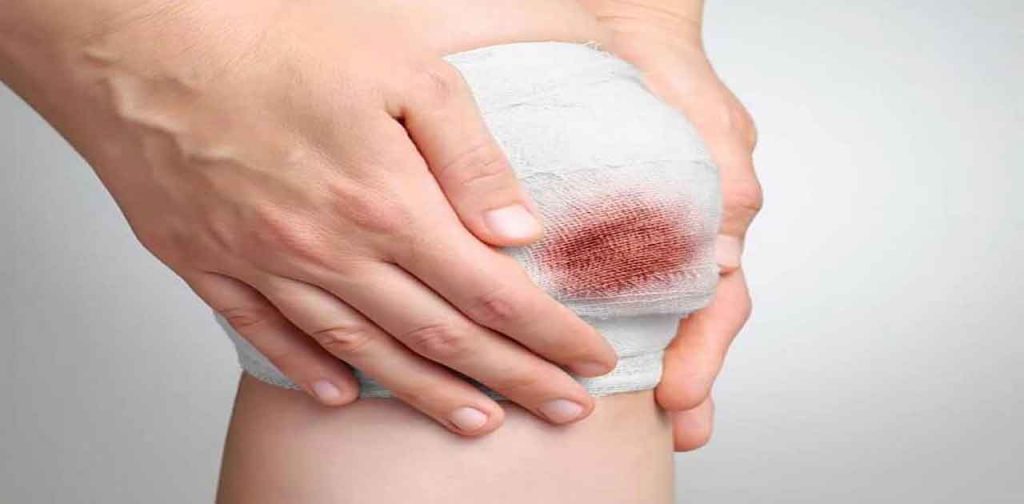 Máy trị sẹo xe tại các spa, thẩm mỹ viện