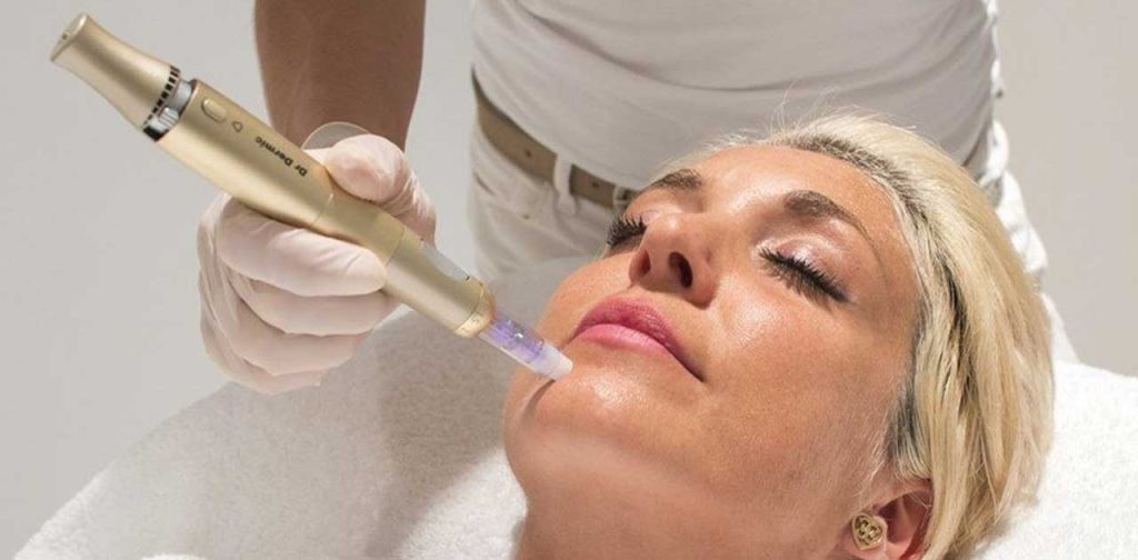 Phương pháp vi kim làm đẹp cao cấp