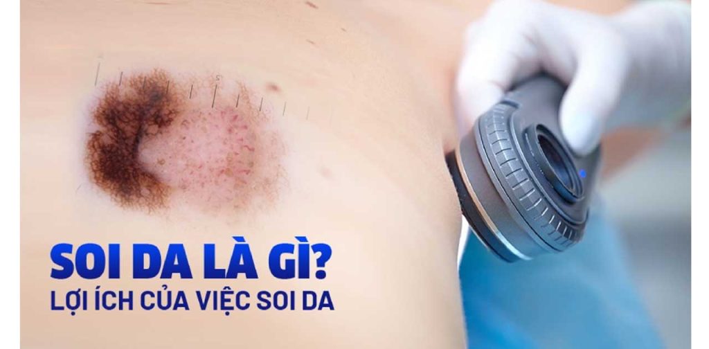 Soi da cso tác dụng gì đến sức khỏe sắc đẹp