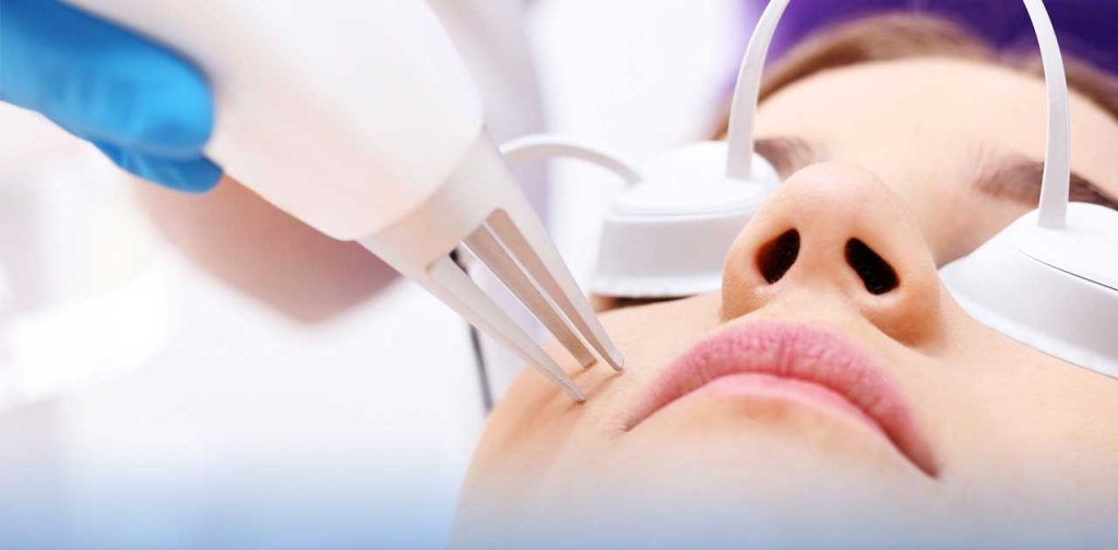 laser toning giải pháp làm đẹp hiệu quả