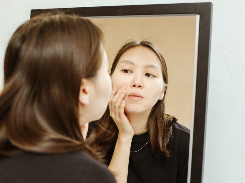 Phụ nữ châu Á soi gương kiểm tra vùng nám sạm khi dùng tranexamic acid